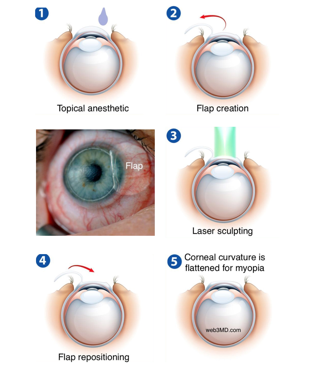 Lasik Eye Surgeon In Ghatkopar, Mumbai